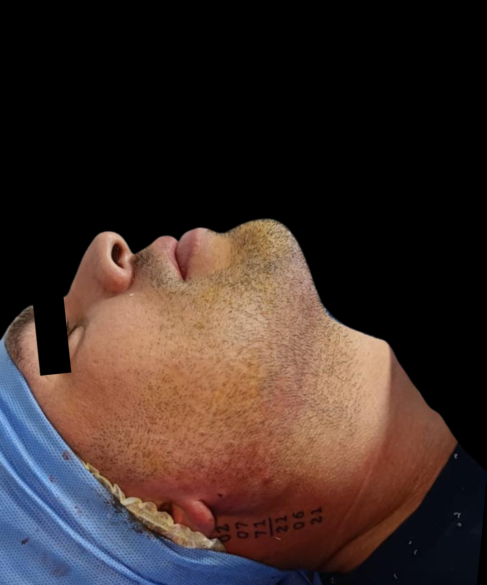 Después