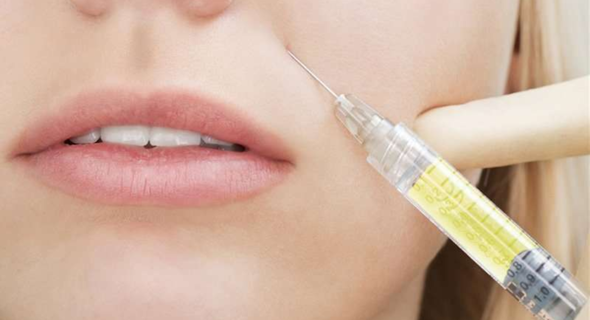 biofiller-plasma gel